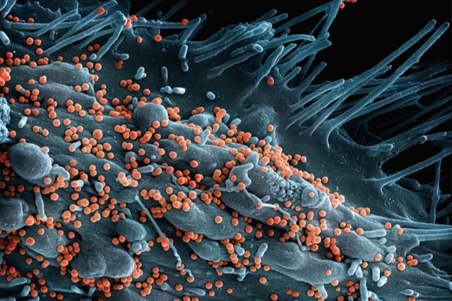 Intestin et microbiote : ce qui influence votre digestion