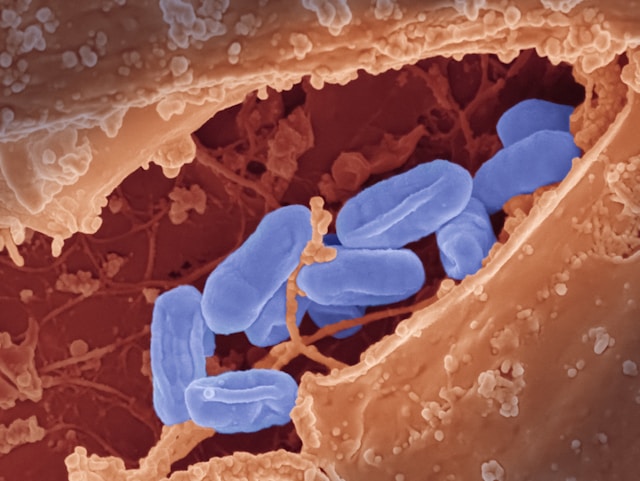 Microbiote intestinal