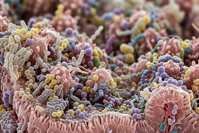 Les secrets du microbiote : tout comprendre sur votre deuxième cerveau